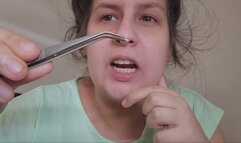 Dental Exploration: Digging Deep with Professional Tools!