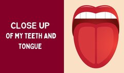 CLOSE UP OF MY TEETH AND TONGUE