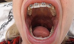 Big wide yawn with a big mouth! MP4