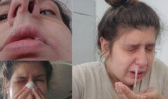 So Sick and Sneezy: Overflowing Mucus, Allergy Fits, and Endless Sneezes