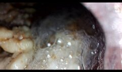 Bailey: Tuna Sandwich Digestion Part 2