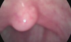 lets take an endoscope tour around the mouth and uvula