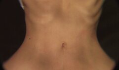 Closeup Oiling Belly Button & Play