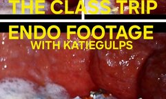 The Class Trip (RAW ENDOSCOPE FOOTAGE)