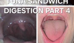 Bailey: Tuna Sandwich Digestion Part 4
