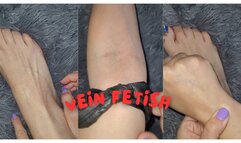 I am so white that my veins are very noticeable