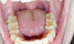 teeth tour -admire my super sexy teeth