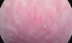 Sexy endoscope mouth tour, uvula and looking down the throat