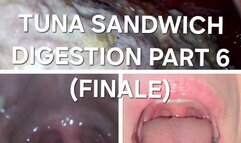 Bailey:Tuna Sandwich Digestion Part 6 (FINALE)