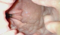 Katie's Empty Stomach