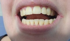 Testing Tooth Whitening Products – Close-Up of My Yellow Teeth Transformation