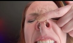 Pignose Sneezes with Lots of Snot