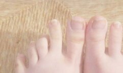 I haven't cut my toenails in 3 months! Ingrown toenail