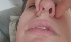 Restless Night: So Many Noisy Sounds from My Stuffy Nose