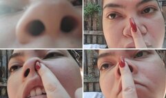 Jessie's nose is unique!!!