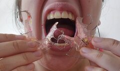 First Time Wearing Retainers, Lots of Drool, Close-Up Details