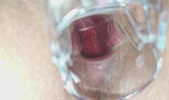 My speculum inside my ass so perfect as I will open my big ass hitachi in pussy and orgasms