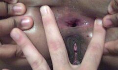 Showing Everyone Her Gaping Asshole!