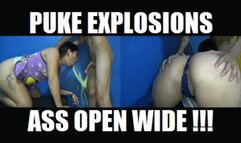 DEEP THROAT FUCKING PUKE 250216DA2 CANDY DEEPTHROAT PUKING ASS WIDE OPEN + FREE SURPRISE SHOW (LOWDEF SD MP4 VERSION)