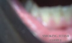 Giovanni's Mouth Interior