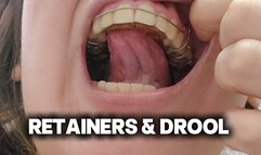 Drooling While Talking with Retainers for the First Time