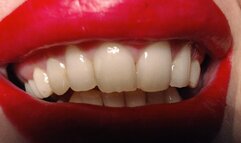 My sharp teeth are looking for you