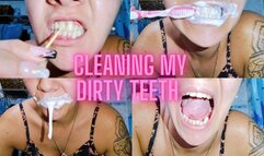 Cleaning my dirty teeth