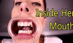 Inside Nikki's Mouth (iPhone)