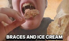 Retainers and Ice Cream Disaster!