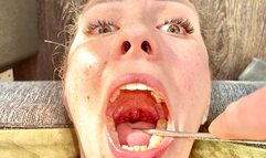 Doctor's Deep Oral Examination POV
