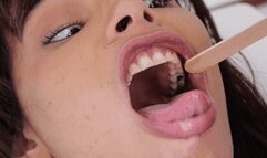 Miss May and her old fillings ( MOUTH FETISH )
