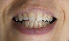 Greasy Chicken Thighs Get Chewed ASMR Sloppy Eating Burping