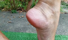 Pronounced arches, wrinkled soles, toenails, toe nails, etc (3)