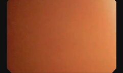 POV Gastroscopía Inmersiva - Viaje Completo por el Interior del Cuerpo - Experiencia Vore Médica en HD 1080p