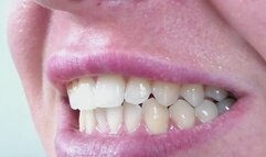 fetish mouthsharp teeth miss avi clip woow