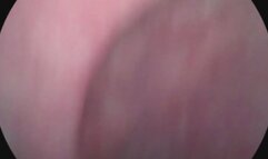 endoscope uvula touching tour