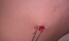 Another bellybutton waxing