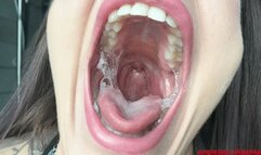 Wet, wide, tearful yawn HD