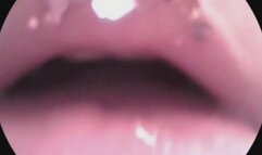 endoscope glittery lips 2