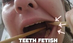 Chopsticks Exploring My Teeth