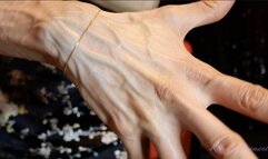 The large and numerous veins in my hands, even moving like a snake!