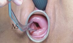 MASTURBATION OF MY OPEN-MOUTHED CERVIX 4k