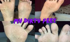 DIRTY FEET and my fingers open