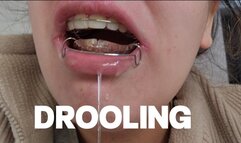 DROOLING FETISH (USING RETAINERS)
