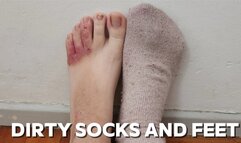 Taking Off My Dirty Socks to Show My Toes