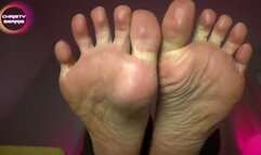 FEET WILL RUIN YOUR LIFE