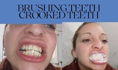 Crooked Tooth Fetish and Tooth Brushing Natural Dental
