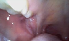 Vicky's Endoscopic Mouth Tour