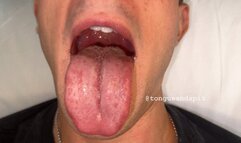 Louis Hillcrest Mouth and Tongue Part9 Video1 - MP4