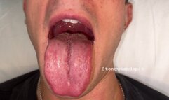 Louis Hillcrest Mouth and Tongue Part9 Video1 - WMV